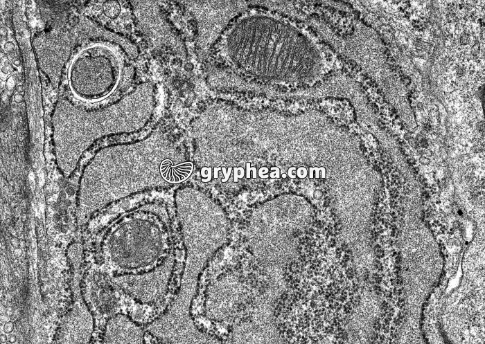 Reticulum endoplasmique granulaire dilaté et mitochondries MET x 17000 - gryphea.com